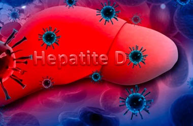 DOENÇAS VIRAIS: HEPATITE D