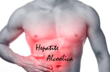 Hepatite alcóolica
