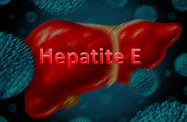DOENÇAS VIRAIS: HEPATITE E